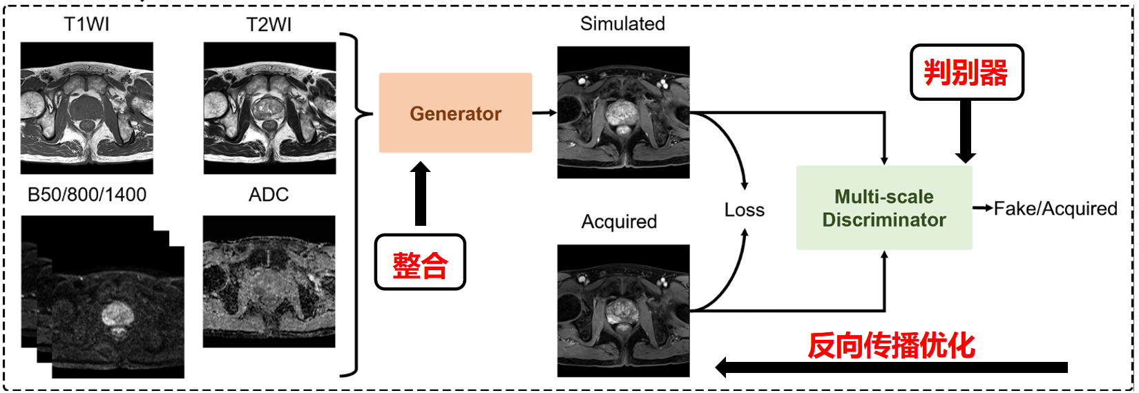 低造影剂3