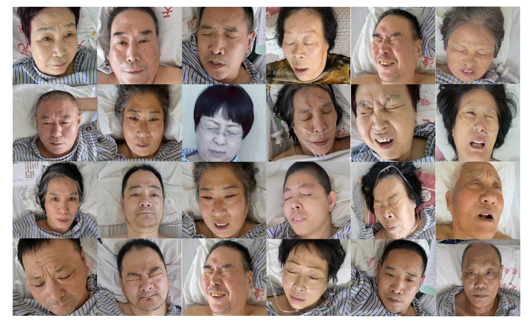 疼痛评估1