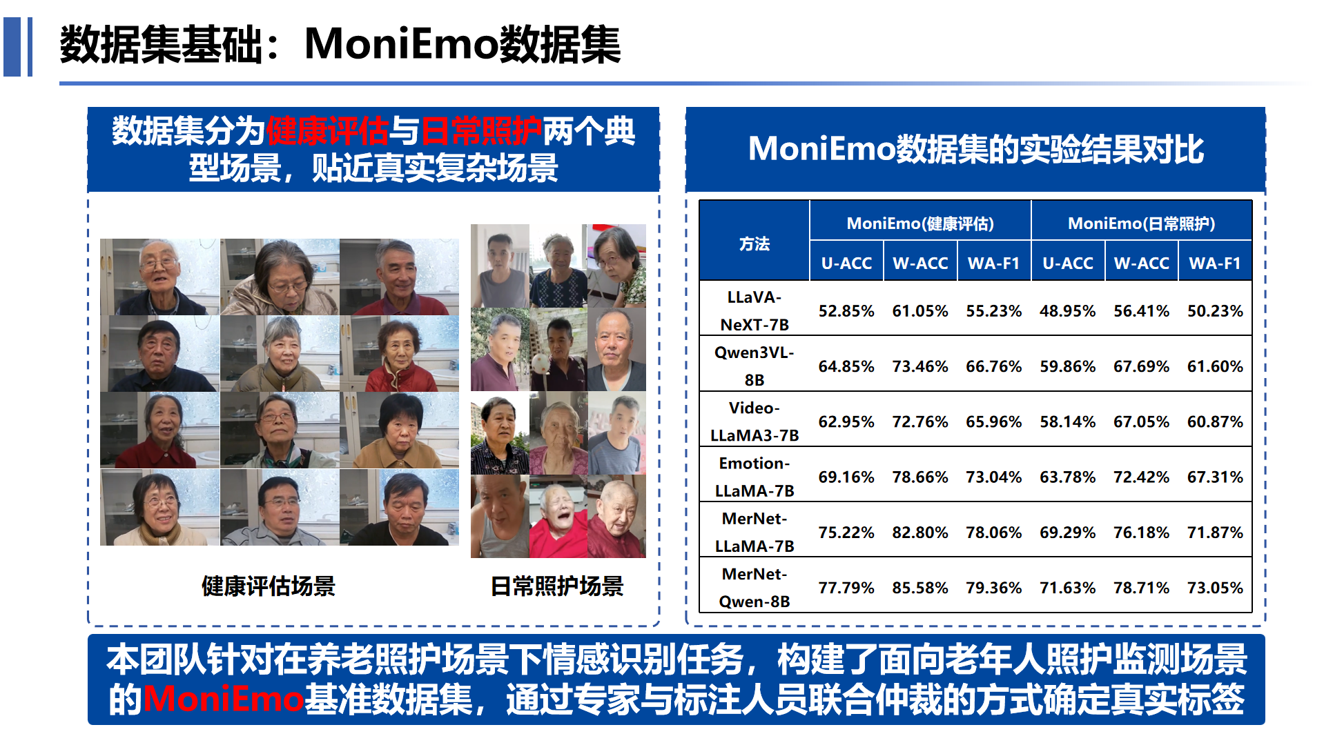认知障碍1