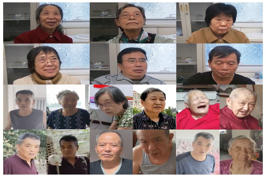 认知障碍2